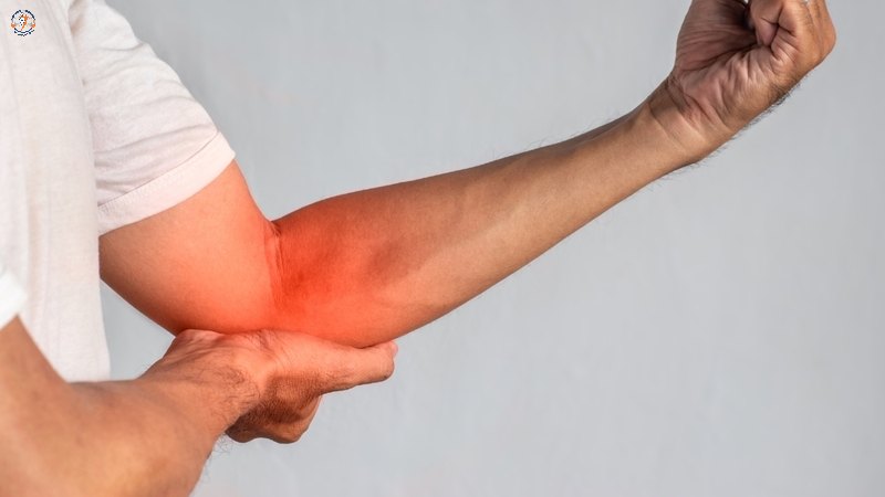 Viêm gân là tình trạng gân bị kích thích mạnh